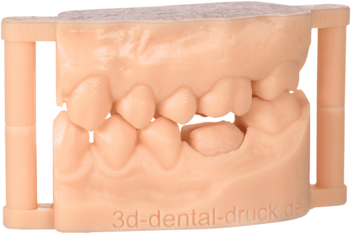 Dentalmodell (Quader OK+UK)